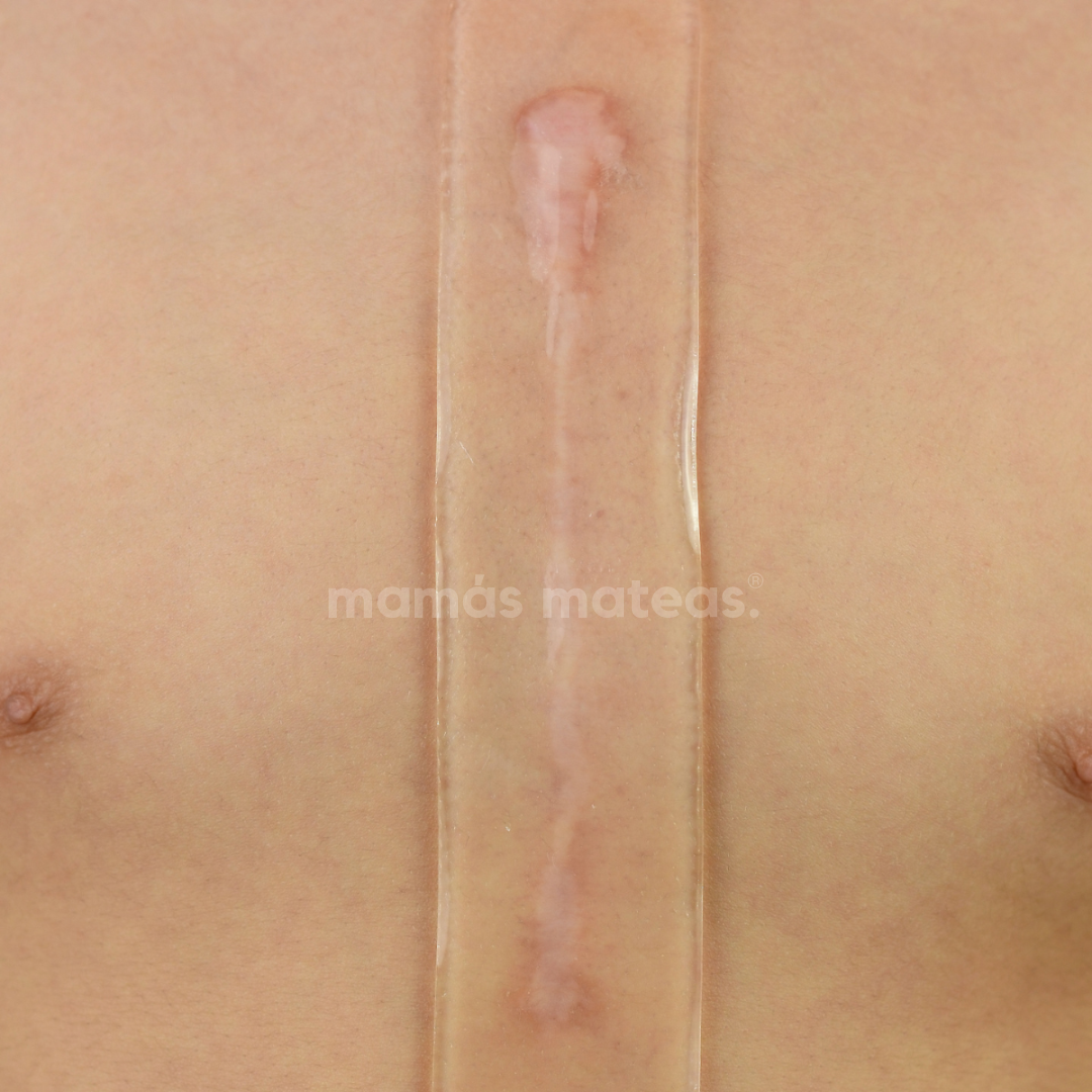 Lámina de Silicona para Cicatrices PIURMED® (Apta para Cesárea) | Piurmed