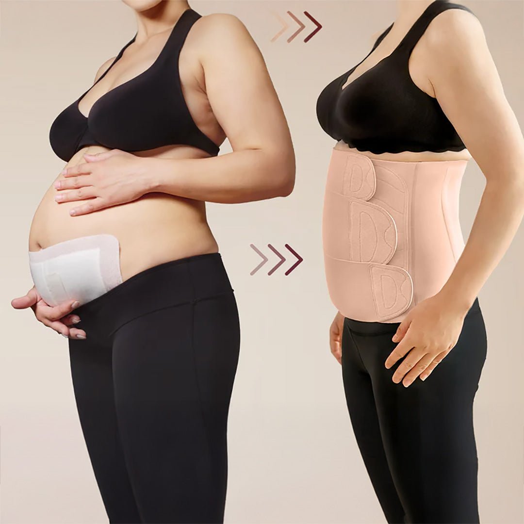 Faja Post Parto Ergowrap - Rosa | Momcozy